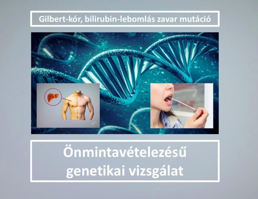 Zns016 Gilbert F