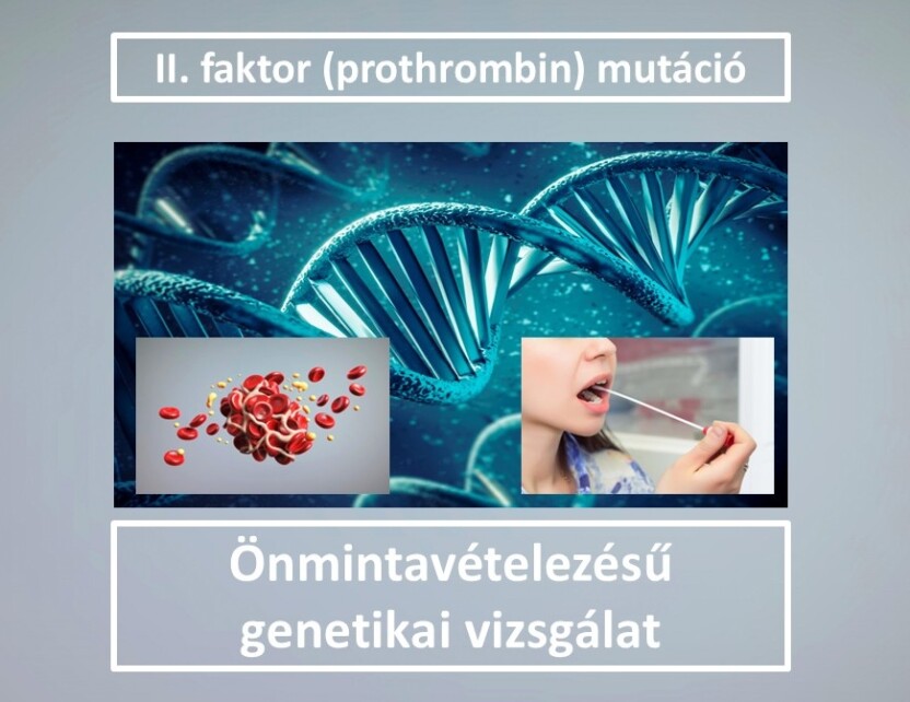 Zns018 Ii Faktor Ii