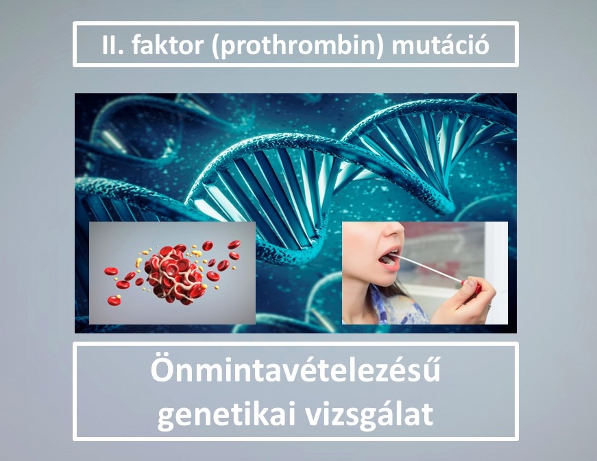Zns018 Ii Faktor Ii